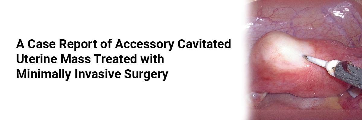 A case report of Accessory Cavitated Uterine Mass Treated with Minimally Invasive Surgery