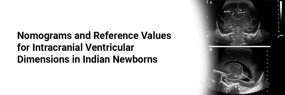 Nomograms and Reference Values for Intracranial Ventricular Dimensions in Indian Newborns