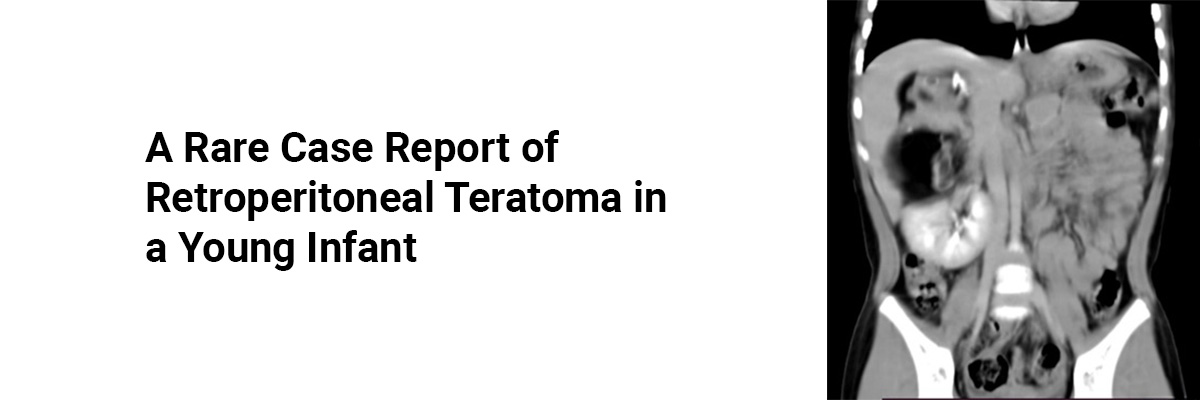 A Rare Case report of Retroperitoneal Teratoma in a Young Infant