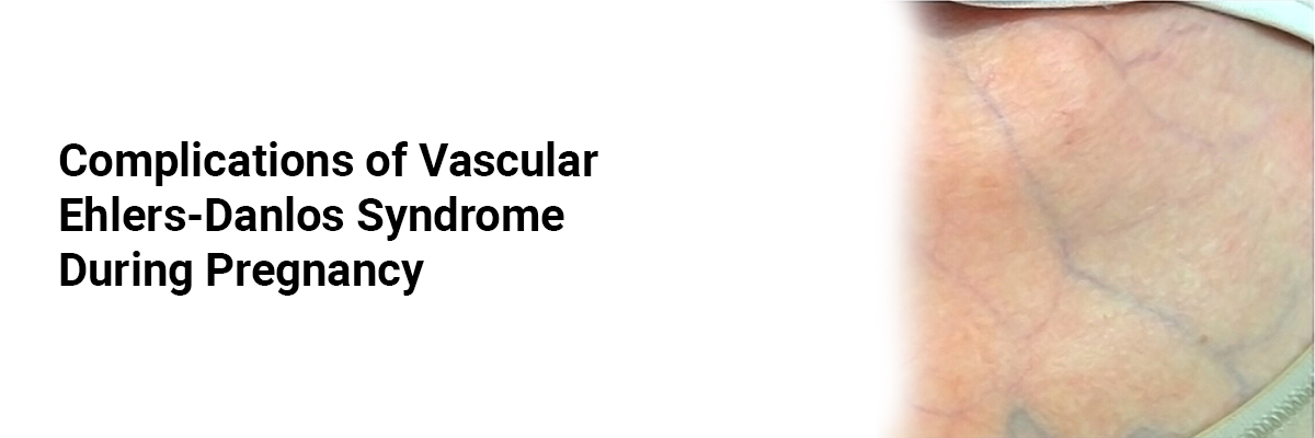 Complications of Vascular Ehlers-Danlos Syndrome During Pregnancy