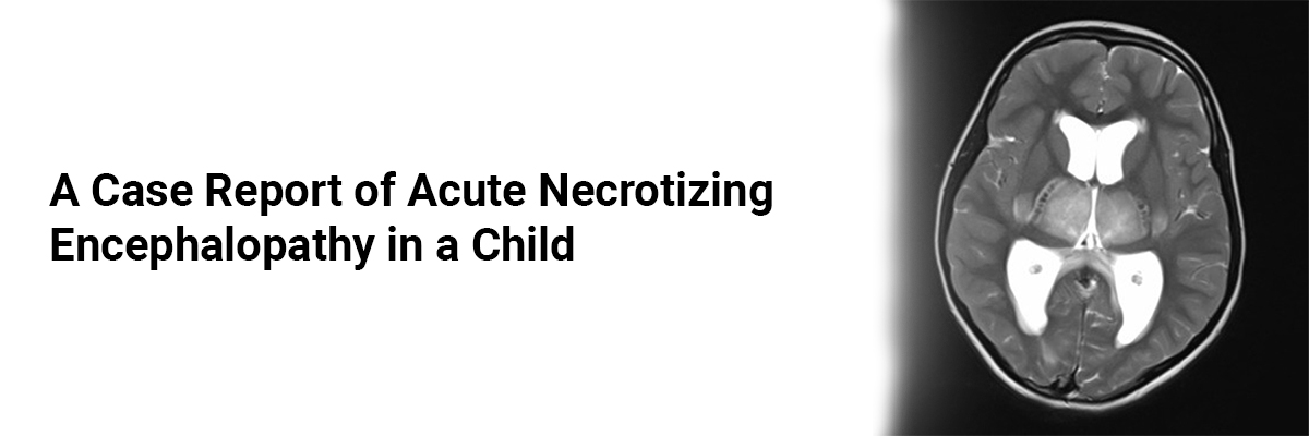 A case report ofAcute Necrotizing Encephalopathy in a Child