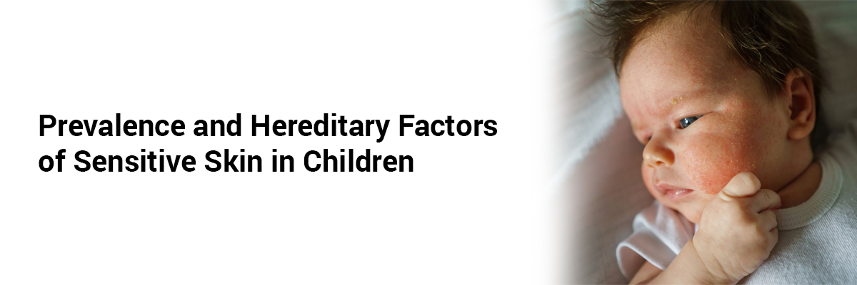Prevalence and Hereditary Factors of Sensitive Skin in Children