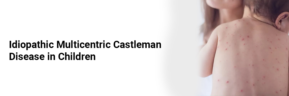 Idiopathic Multicentric Castleman Disease in Children