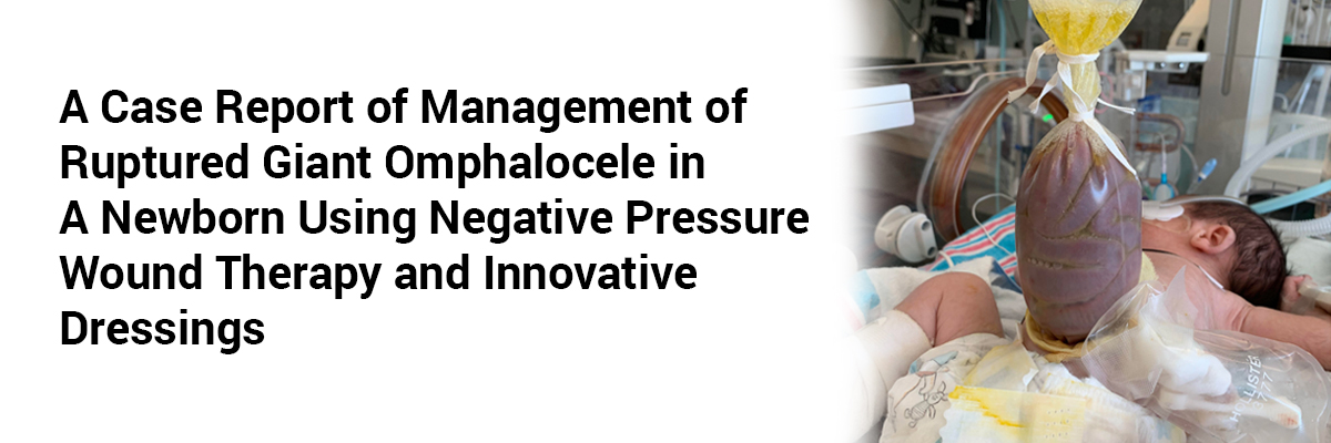 A case report of Management of Ruptured Giant Omphalocele in a Newborn Using Negative Pressure Wound Therapy and Innovative Dressings
