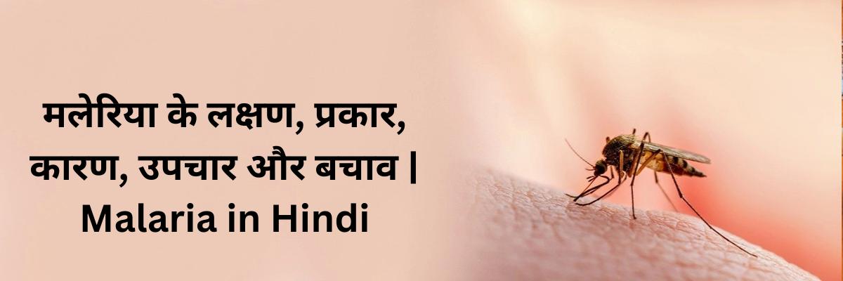 मलेरिया के लक्षण, प्रकार, कारण, उपचार और बचाव | Malaria in Hindi