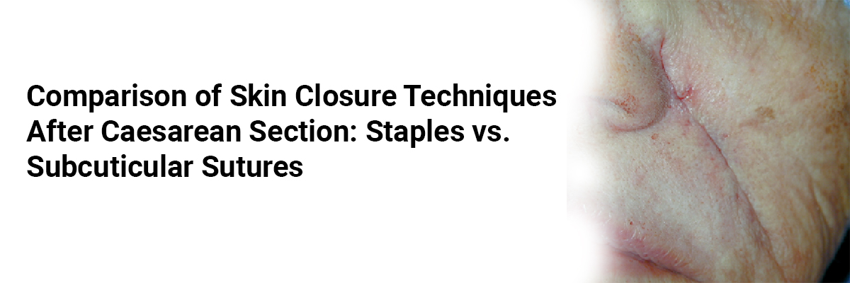 Comparison of Skin Closure Techniques After Caesarean Section: Staples vs. Subcuticular Sutures