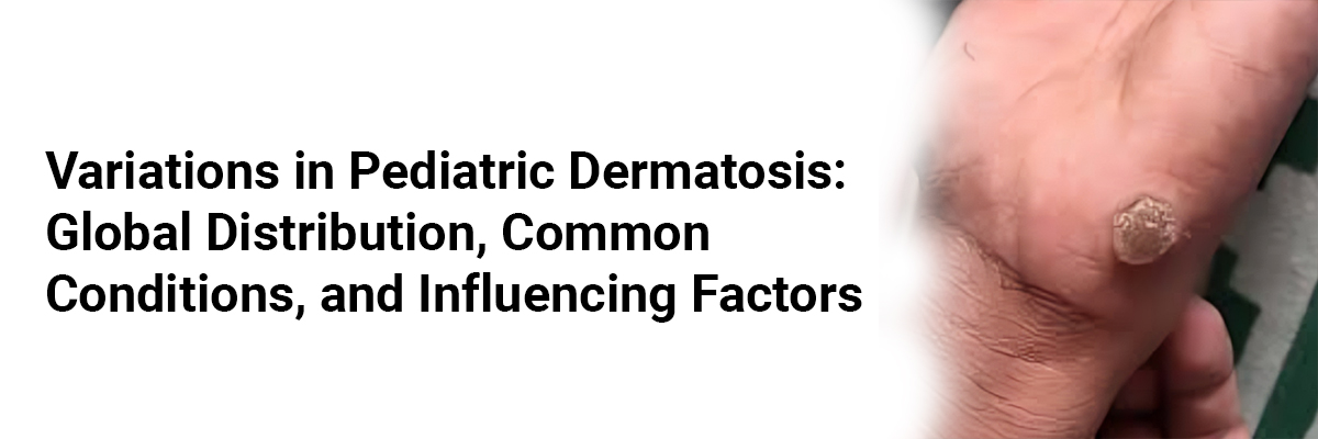 Variations in Pediatric Dermatosis: Global Distribution, Common Conditions, and Influencing Factors