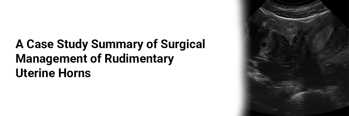 A case study summary of Surgical Management of Rudimentary Uterine Horns