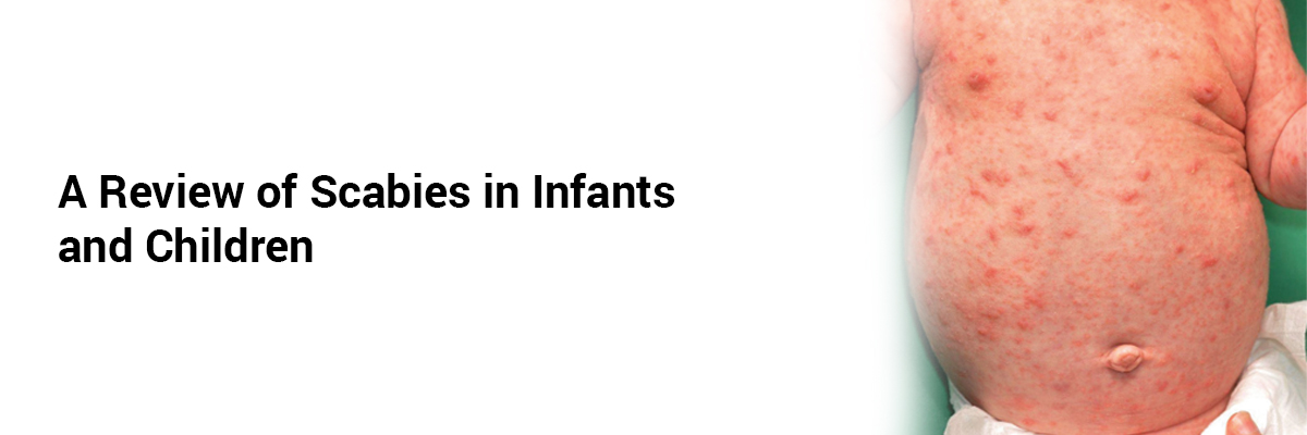 A review of Scabies in infants and children