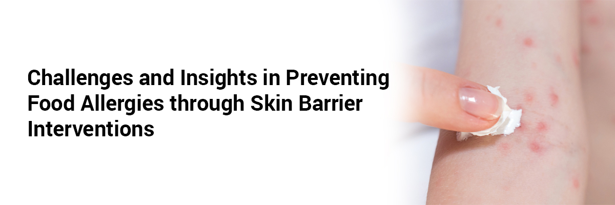 Challenges and Insights in Preventing Food Allergies through Skin Barrier Interventions