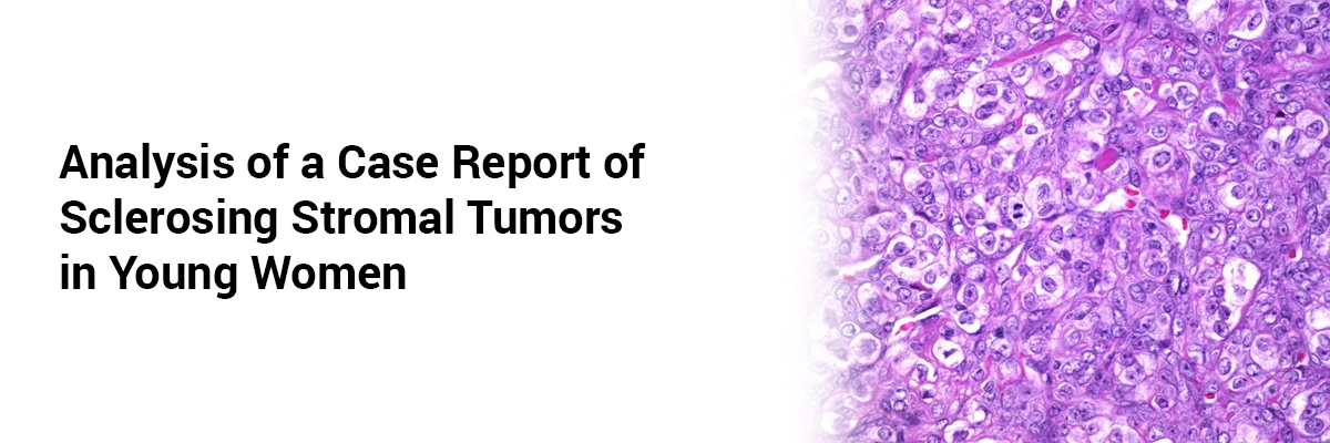 Analysis of a Case Report of Sclerosing Stromal Tumors in Young Women