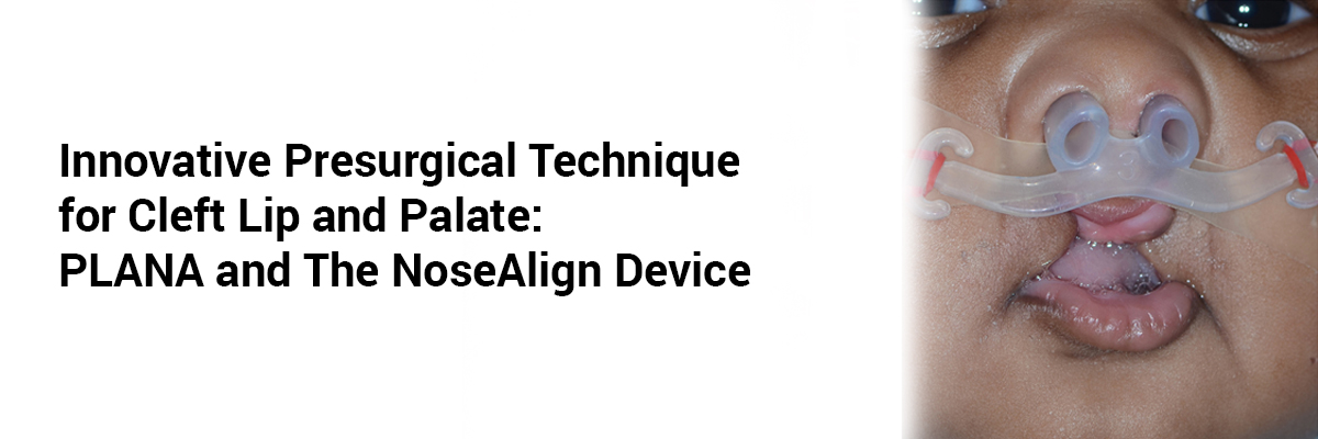 Innovative Presurgical Technique for Cleft Lip and Palate: PLANA and the NoseAlign Device