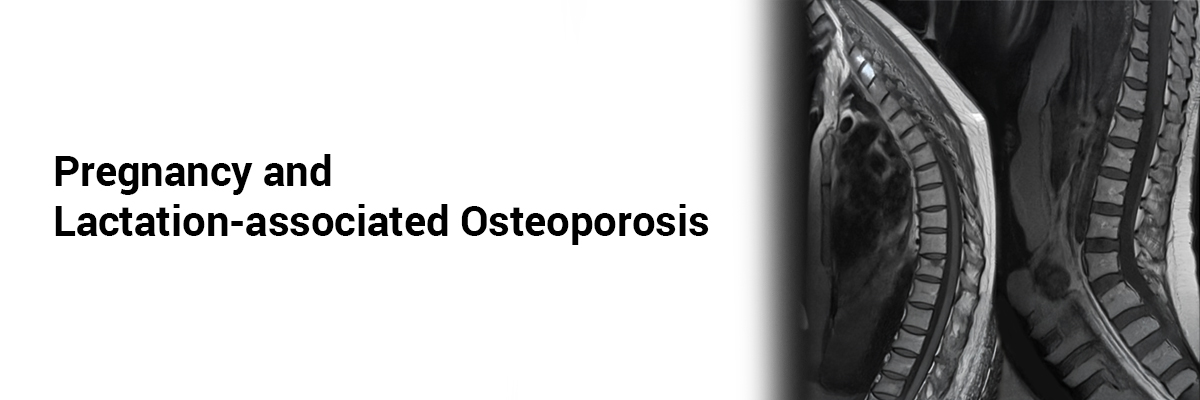 Pregnancy and Lactation-associated Osteoporosis
