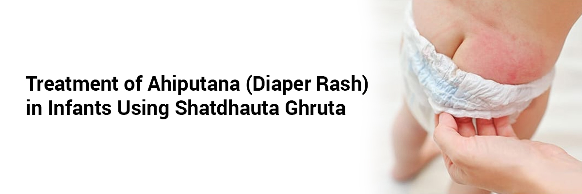 Treatment of Ahiputana (Diaper Rash) in Infants Using Shatdhauta Ghruta