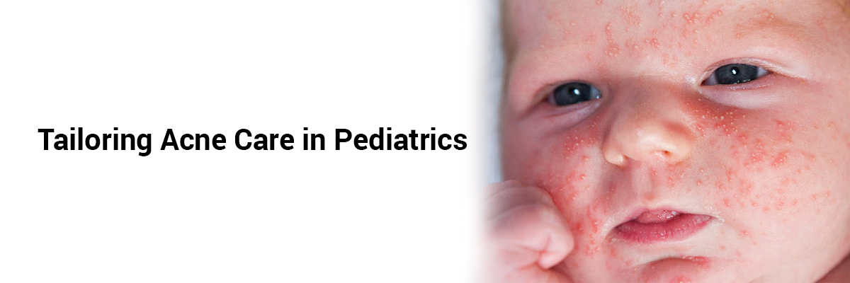 Tailoring Acne Care in Pediatrics