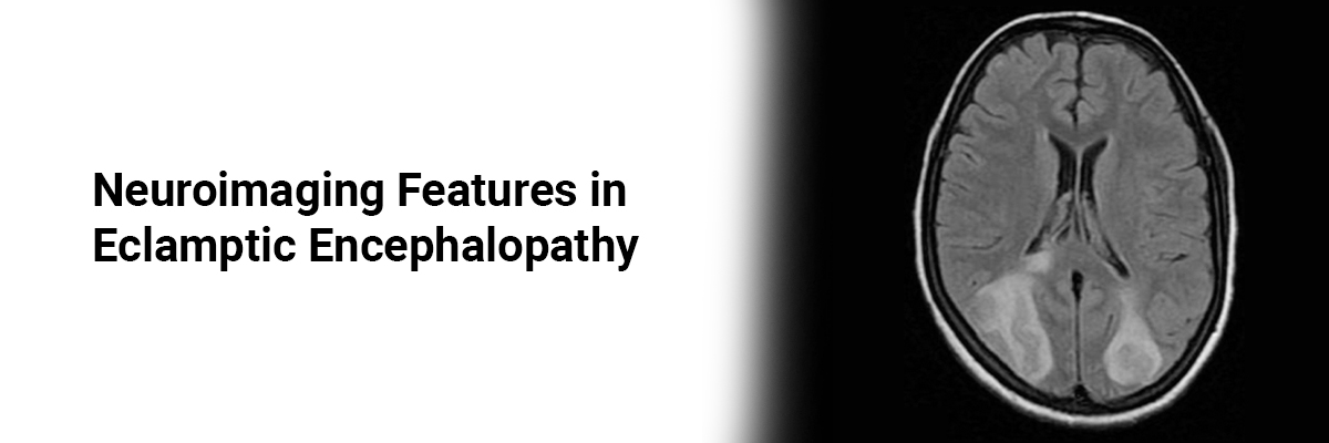 Neuroimaging Features in Eclamptic Encephalopathy 