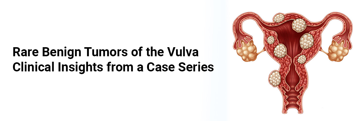 Rare Benign Tumors of the Vulva: Clinical Insights from a Case Series