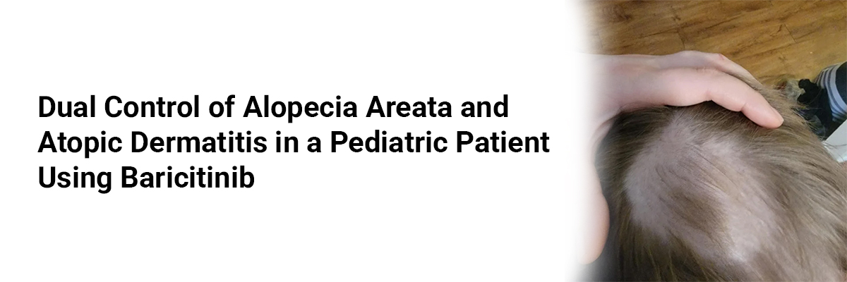Dual Control of Alopecia Areata and Atopic Dermatitis in a Pediatric Patient Using Baricitinib