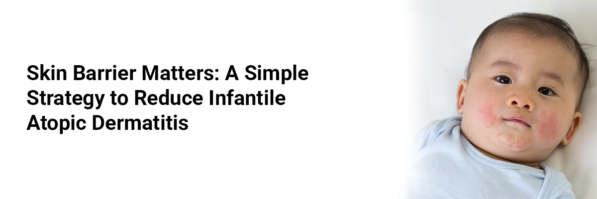 Skin Barrier Matters: A Simple Strategy to Reduce Infantile Atopic Dermatitis