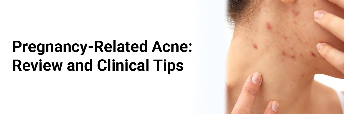 Pregnancy-Related Acne: Review and Clinical Tips