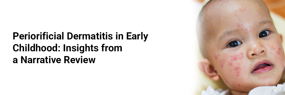 Periorificial Dermatitis in Early Childhood: Insights from a Narrative Review
