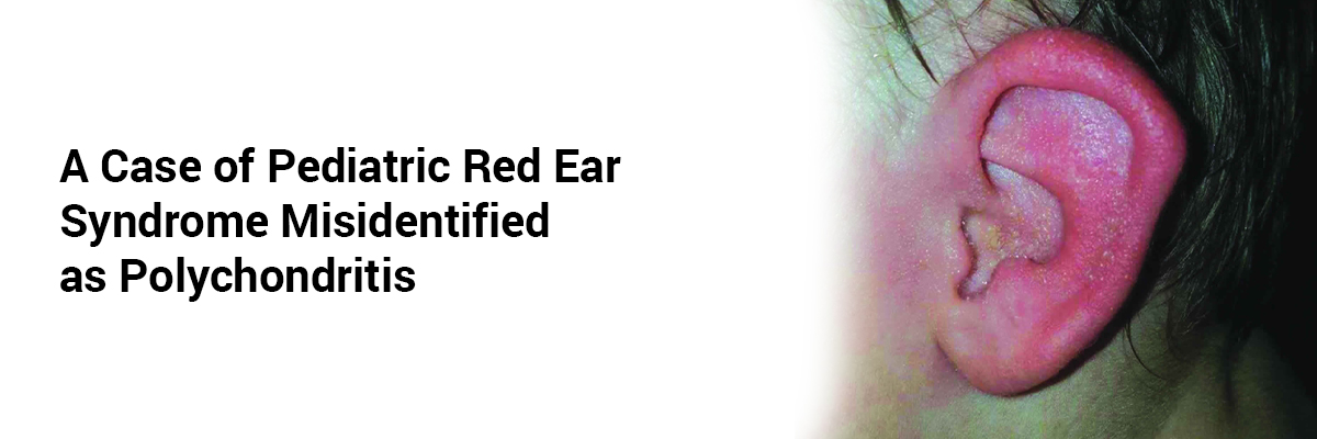 A Case of Pediatric Red Ear Syndrome Misidentified as Polychondritis