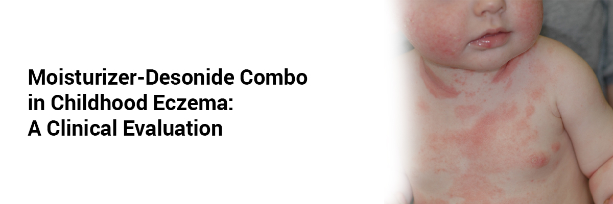 Moisturizer-Desonide Combo in Childhood Eczema: A Clinical Evaluation