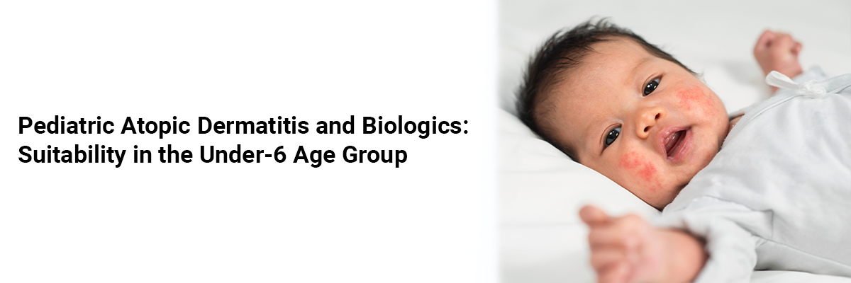 Pediatric Atopic Dermatitis and Biologics: Suitability in the Under-6 Age Group