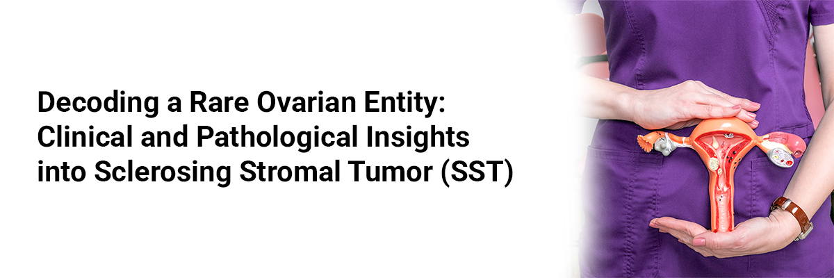 Decoding a Rare Ovarian Entity: Clinical and Pathological Insights into Sclerosing Stromal Tumor (SST)
