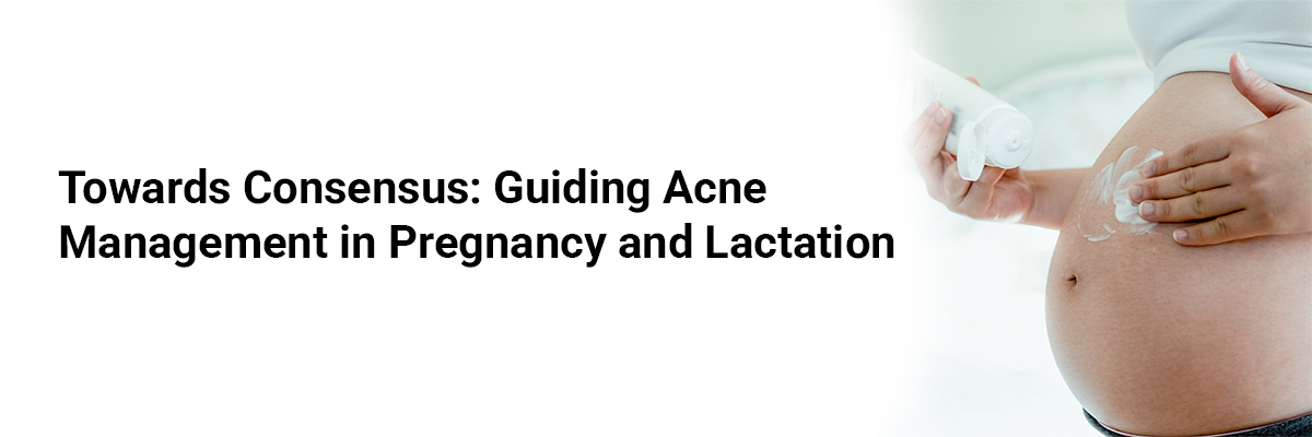 Towards Consensus: Guiding Acne Management in Pregnancy and Lactation