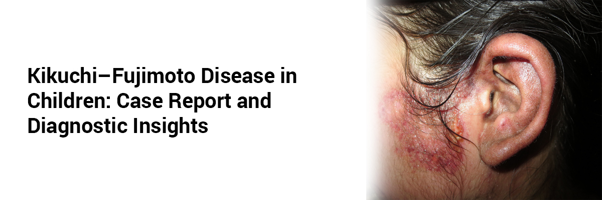 Kikuchi–Fujimoto Disease in Children: Case Report and Diagnostic Insights