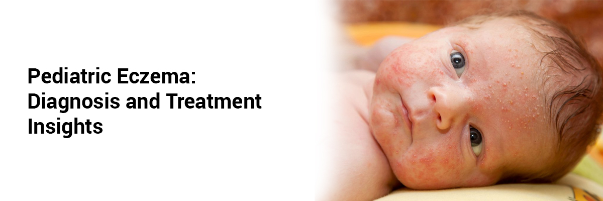  Pediatric Eczema: Diagnosis and Treatment Insights