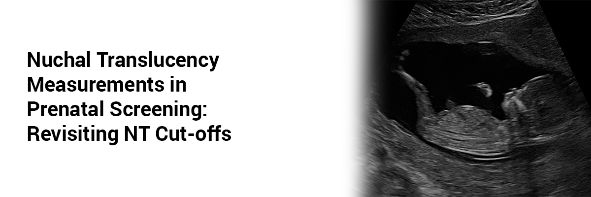 Nuchal Translucency Measurements in Prenatal Screening: Revisiting NT Cut-Offs