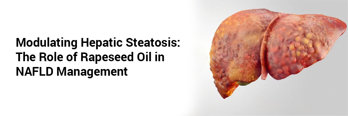 Modulating Hepatic Steatosis: The Role of Rapeseed Oil in NAFLD Management