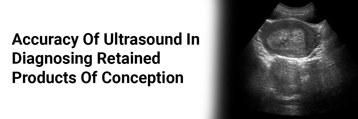 Accuracy of Ultrasound in Diagnosing Retained Products of Conception