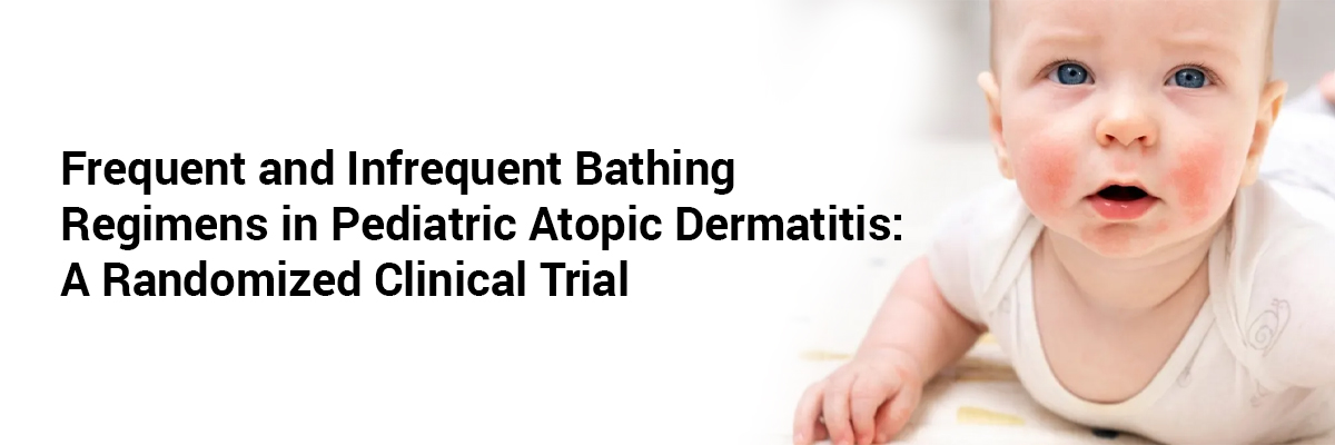 Frequent and Infrequent Bathing Regimens in Pediatric Atopic Dermatitis: A Randomized Clinical Trial