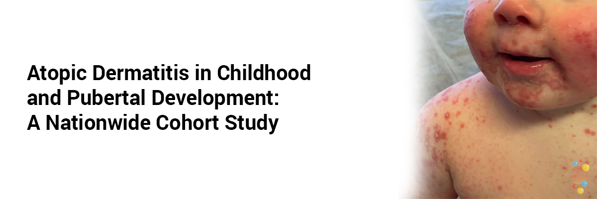 Atopic Dermatitis in Childhood and Pubertal Development: A Nationwide Cohort Study