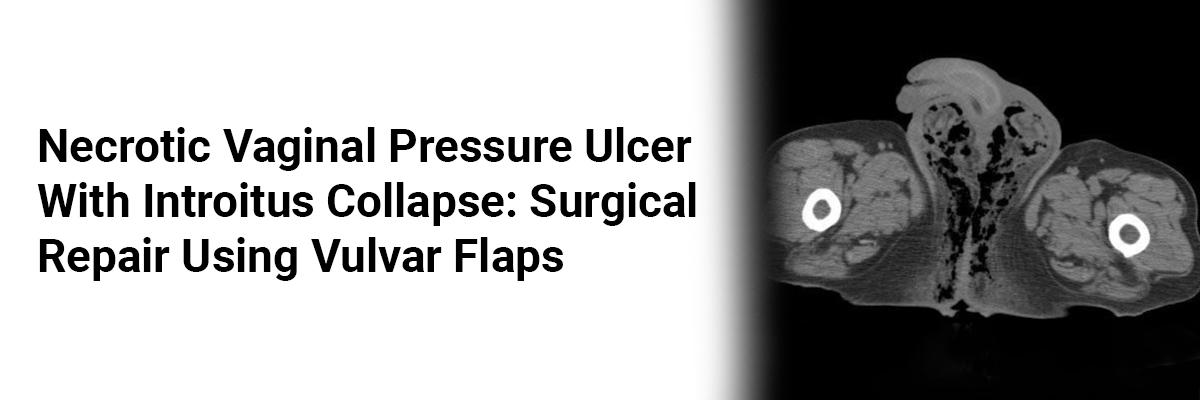Necrotic Vaginal Pressure Ulcer with Introitus Collapse: Surgical Repair Using Vulvar Flaps