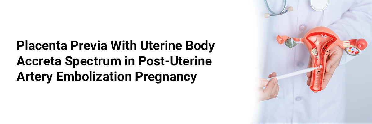 Placenta Previa with Uterine Body Accreta Spectrum in Post-Uterine Artery Embolization Pregnancy