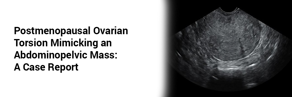 Postmenopausal Ovarian Torsion Mimicking an Abdominopelvic Mass: A Case Report
