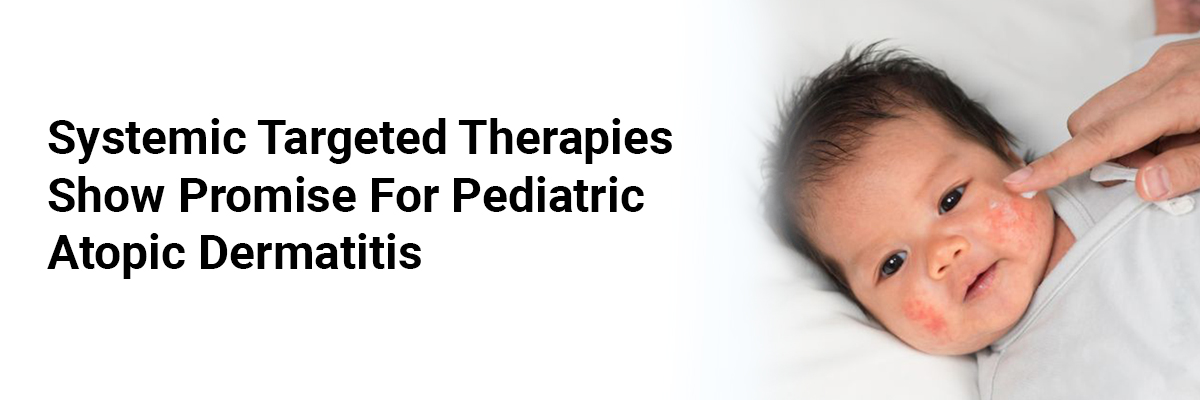 Systemic Targeted Therapies Show Promise for Pediatric Atopic Dermatitis