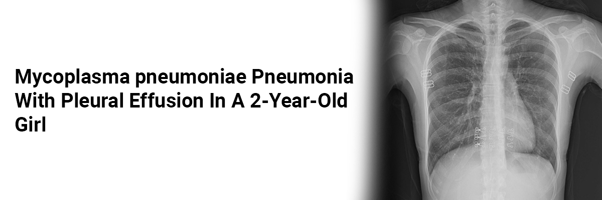 Mycoplasma pneumoniae Pneumonia with Pleural Effusion in a 2-Year-Old Girl