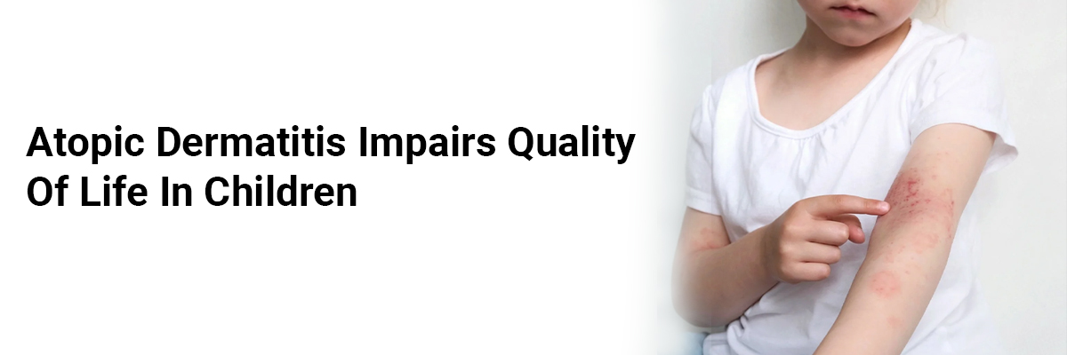 Atopic Dermatitis Impairs Quality of Life in Children