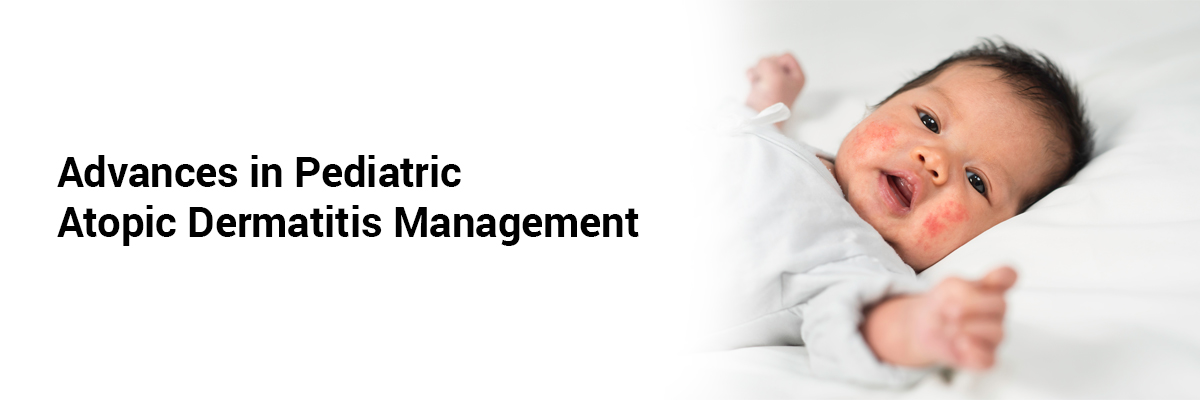 Advances in Pediatric Atopic Dermatitis Management