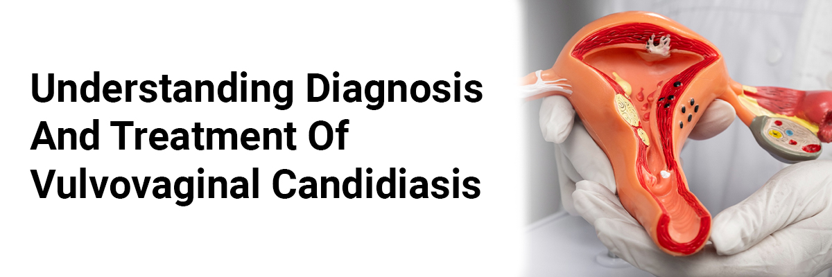 Understanding Diagnosis and Treatment of Vulvovaginal Candidiasis