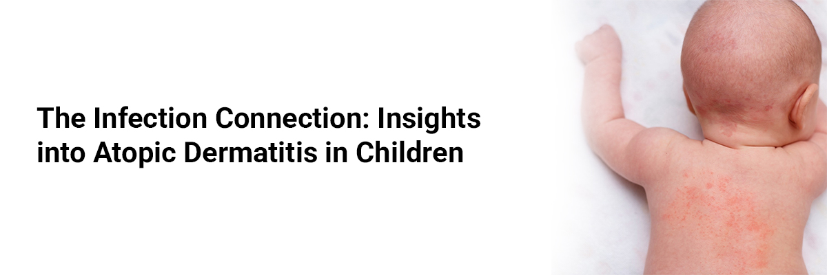 The Infection Connection: Insights into Atopic Dermatitis in Children 