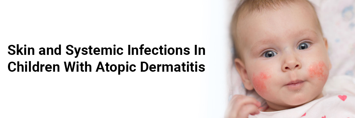 Skin and Systemic Infections in Children with Atopic Dermatitis
