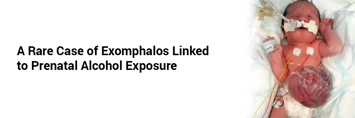 A Rare Case of Exomphalos Linked to Prenatal Alcohol Exposure