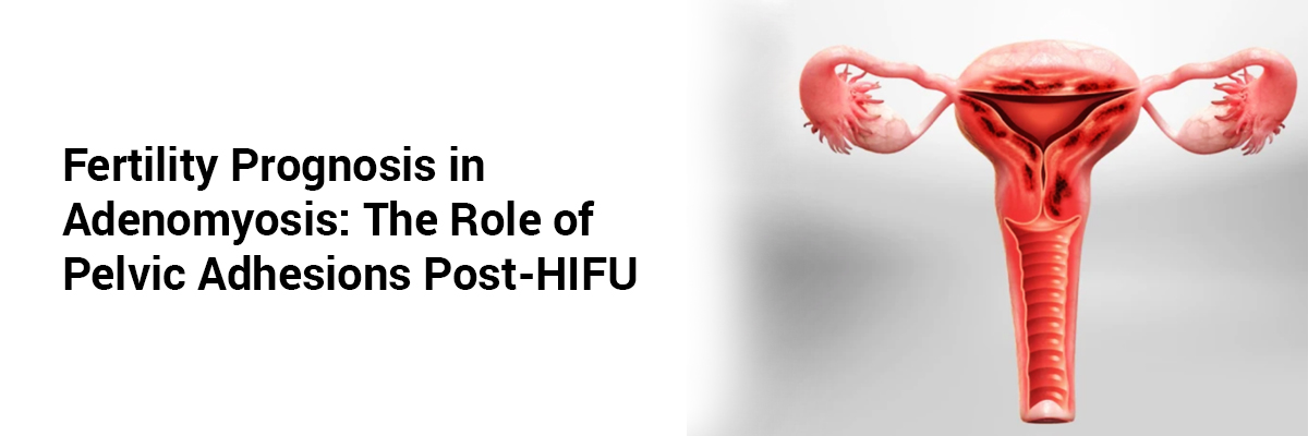 Fertility Prognosis in Adenomyosis: The Role of Pelvic Adhesions Post-HIFU