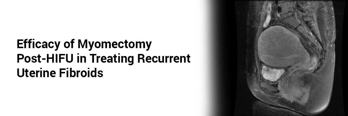 Efficacy of Myomectomy Post-HIFU in Treating Recurrent Uterine Fibroids